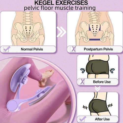 Image de Entraîneur Kegel Rose - Renforcez Votre Plancher Pelvien à Domicile