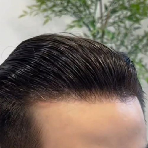 Vue 5 du produit