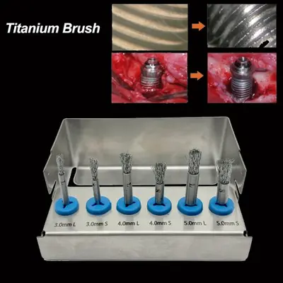 Image de Brosse Nettoyante pour Implants Dentaires - Ensemble de 6 Pièces en Titane