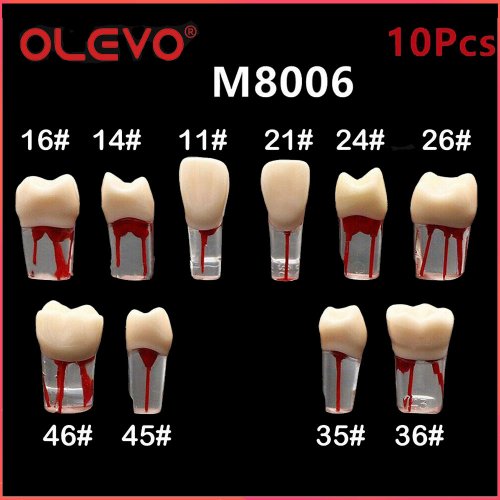 Image de Kit Modèle Endodontique 10 Pièces pour Formation Dentaire