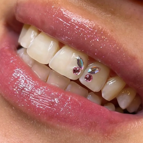 Zdjęcie Kryształowe Biżuteria na Zęby – Eleganckie Klejnoty Motylkowe do Uśmiechu, Dekoracyjne Ozdoby Dentalne z Efektem Diamentowym