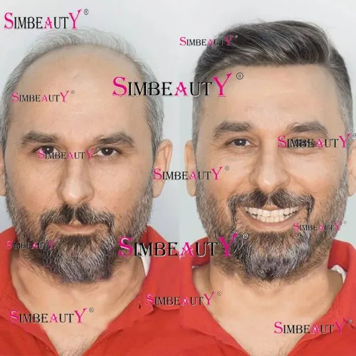 Vue 5 du produit