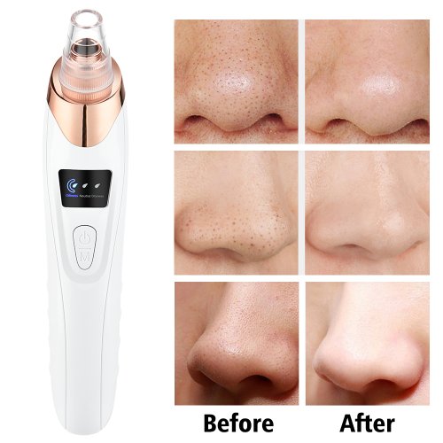 Vue 5 du produit