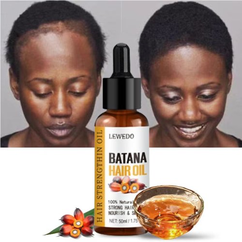 Afbeelding van Lewedo Naturals Batana Olie Snelle Haargroei voor Mannen Vrouwen Pure Batana Olie Voeden Glanzend Haar Gezonde Haarverzo